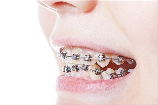 cầu lô bạch thủ miễn phí